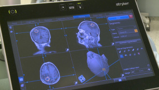 Астраханские нейрохирурги возобновили плановое лечение пациентов