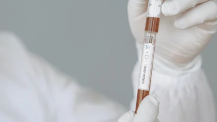 В Астраханской области за сутки 133 человека заразились COVID-19