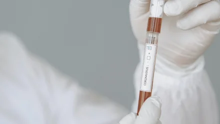 В Астрахани за сутки зафиксировано 170 новых случаев заражения COVID-19