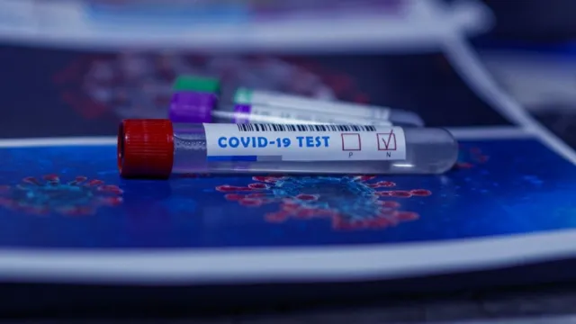 В Астрахани коэффициент распространения COVID-19 снова приближается к 1