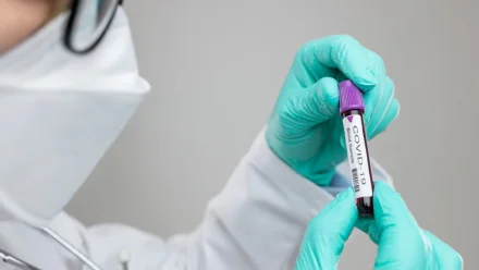 Коэффициент распространения коронавируса в Астрахани вырос до 1,55