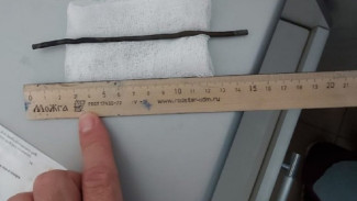 В Астрахани врачи извлекли из желудка мужчины 15-сантиметровый электрод