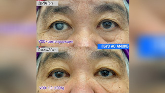 Врач астраханской больницы подарил прозрение пациентке на Новый год