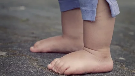 В Астрахани врачи спасли мальчика, пострадавшего при пожаре 