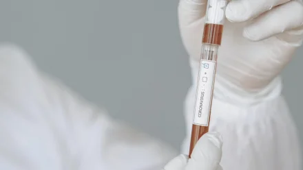 За сутки в Астраханской области у 292 человек выявили коронавирус