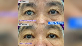 Врач астраханской больницы подарил прозрение пациентке на Новый год