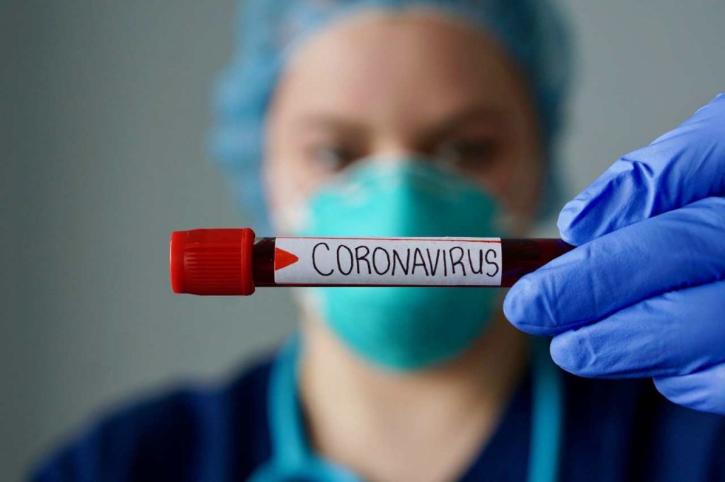 В Астраханской области за сутки выявили 478 новых случаев коронавируса