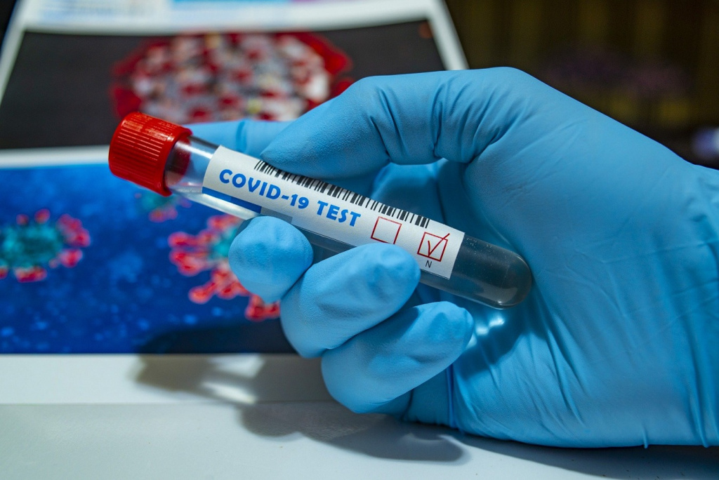 В Астрахани зарегистрировано 49 случаев заражения коронавирусом